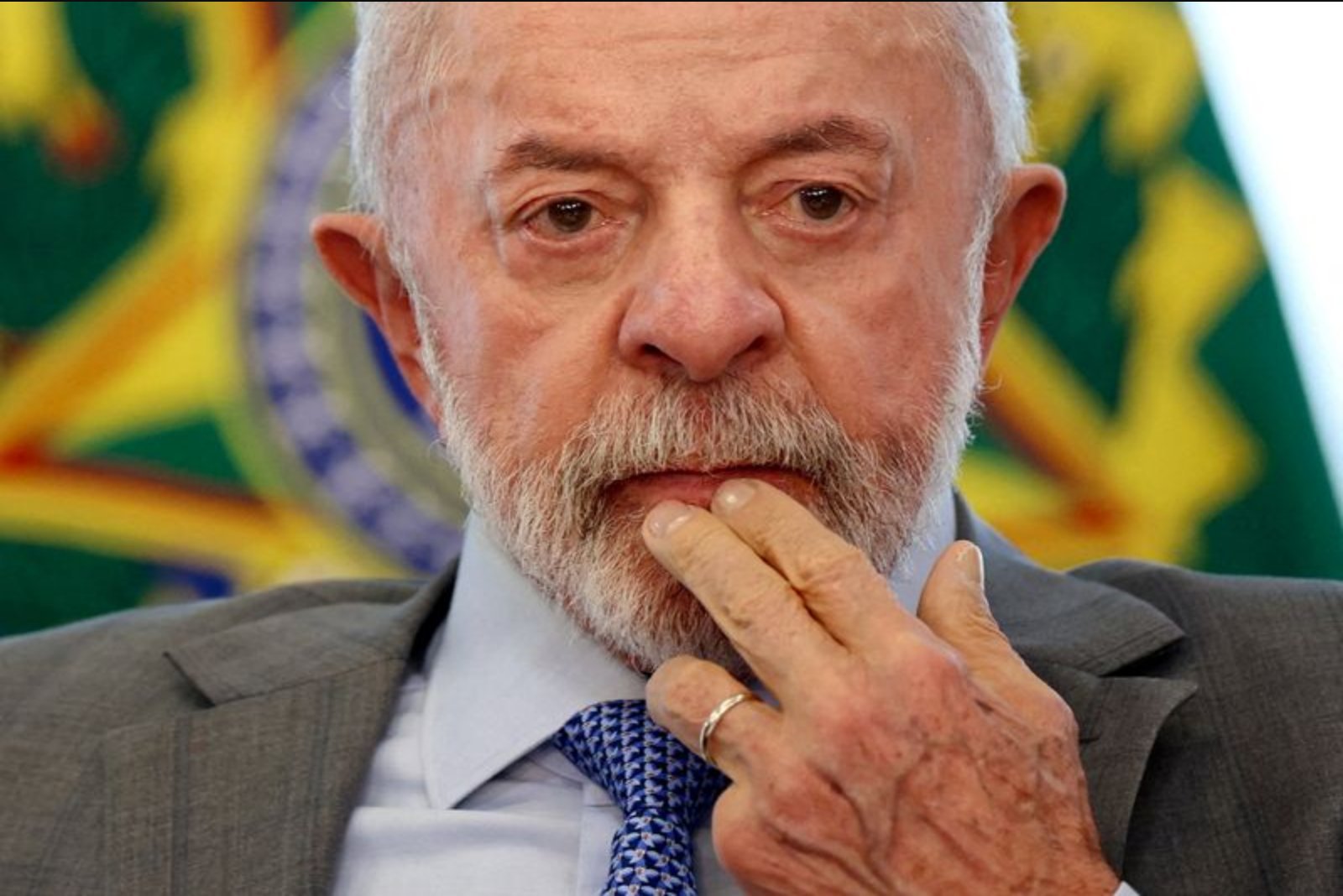 Lula Begins Preventive Radiotherapy After Scalp Lesion Removal