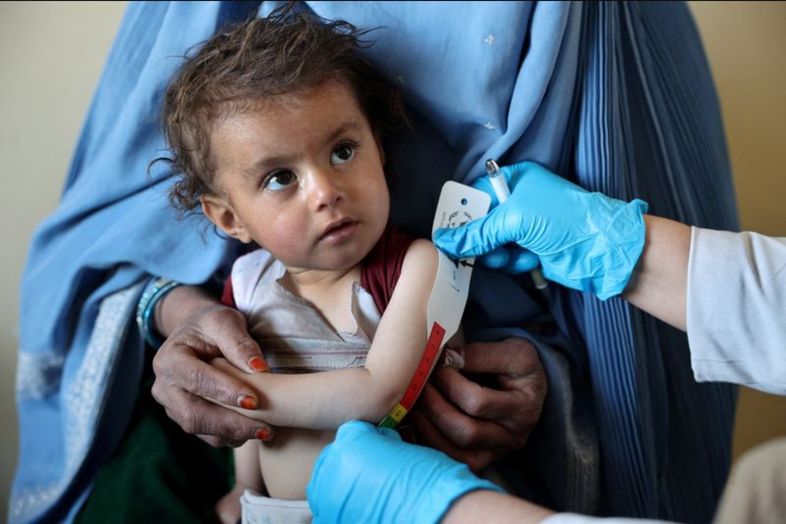 Afghanistan and U.N. Unveil $100 Million Food Security Plan as Hunger Worsens