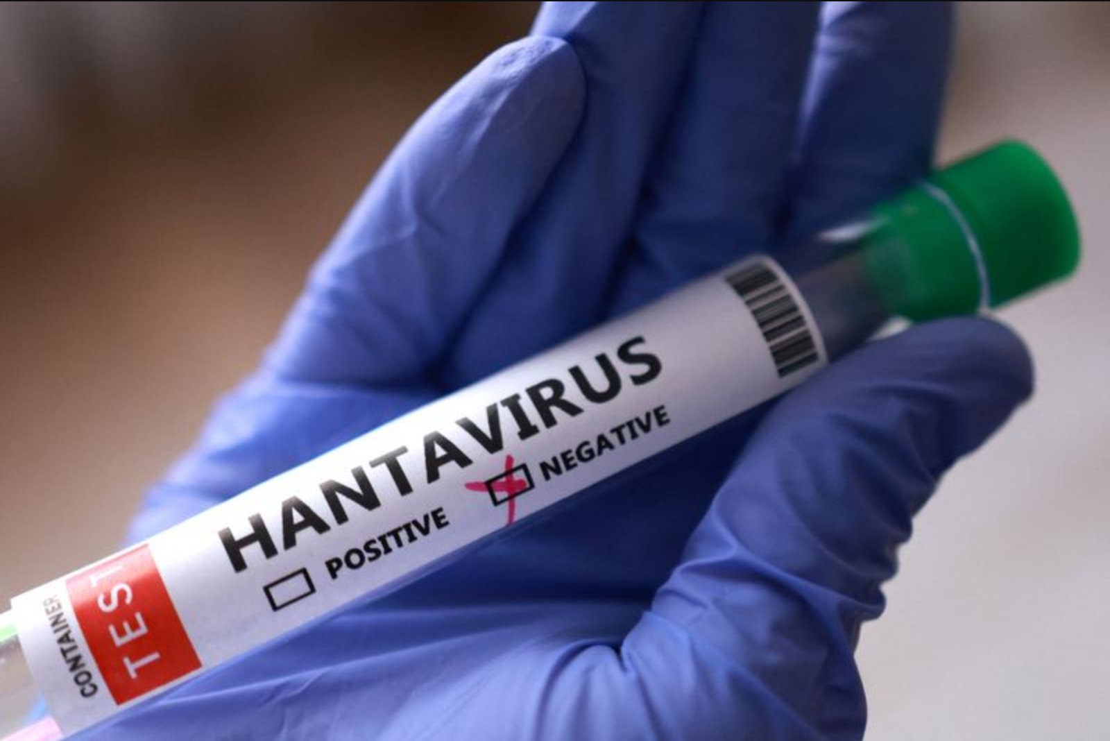 CDC Says Public Risk From Hantavirus Remains Very Low as Response Continues
